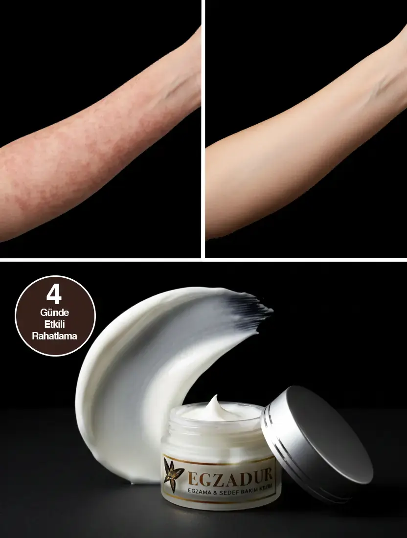 Egzadur krem ürün görseli 4
